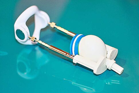 Extender - un dispozitiv pentru o creștere eficientă a unui membru